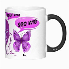 Invisible Illness Collage Morph Mug from ArtsNow.com Right