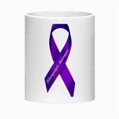 Fibro Awareness Ribbon Morph Mug from ArtsNow.com Center