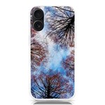 Treetops-2991743 1280 iPhone 16 TPU UV Print Case